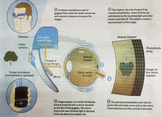 Bionic eye2